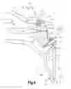 Fig. 05 - Examination apparatus