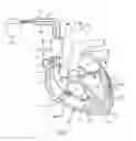 Fig. 02 - CLINICAL APPLICATIONS FOR ELECTRICAL TOMOGRAPHY DERIVED METRICS