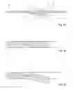 Fig. 04 - Ocular implant