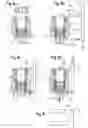 Fig. 06 - BONE ANCHORING DEVICE