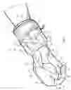 Fig. 02 - Glove having weight-receiving features and weighted features