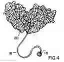 Fig. 04 - Pom-Pom Scarf