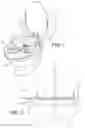 Fig. 02 - Splash shield and kit for use when plunging a toilet