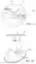 Fig. 05 - Splash shield and kit for use when plunging a toilet