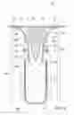 Fig. 07 - DRAIN FITTING