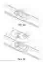Fig. 03 - WINDSCREEN WIPER DEVICE