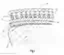 Fig. 02 - Fixing system