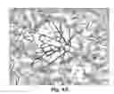 Fig. 05 - PULL UP TREE SYSTEM