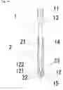 Fig. 19 - Feces collection container