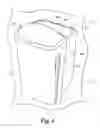 Fig. 02 - AIR FILTRATION DEVICE