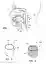 Fig. 02 - Apparatus and methods for treating sleep apnea