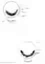 Fig. 02 - Tinted contact lenses with crescent patterns