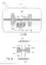 Fig. 10 - Cone-beam CT