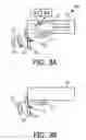 Fig. 04 - X-ray examination apparatus