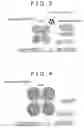 Fig. 04 - Catalyst structure body for fuel cell, manufacture method therefor, membrane-electrode assembly, and fuel cell
