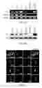 Fig. 02 - USE OF CB2 RECEPTOR AGONISTS FOR PROMOTING NEUROGENESIS