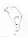 Fig. 02 - Finger Splint Device for Preventing Contractures and the Like and Method of Using Same