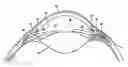 Fig. 01 - Shunt device and method for treating ocular disorders
