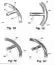 Fig. 02 - Shunt device and method for treating ocular disorders