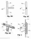 Fig. 04 - Shunt device and method for treating ocular disorders
