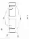 Fig. 04 - Implantable glaucoma drainage device