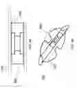 Fig. 09 - Implantable glaucoma drainage device