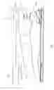 Fig. 03 - System and method for improving the accommodative amplitude and increasing the refractive power of the human lens with a laser