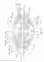 Fig. 22 - System and method for improving the accommodative amplitude and increasing the refractive power of the human lens with a laser