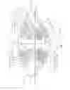 Fig. 23 - System and method for improving the accommodative amplitude and increasing the refractive power of the human lens with a laser