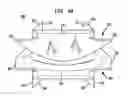 Fig. 07 - Instruments and methods for inserting artificial intervertebral implants