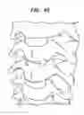 Fig. 43 - Instruments and methods for inserting artificial intervertebral implants