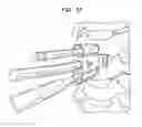 Fig. 45 - Instruments and methods for inserting artificial intervertebral implants