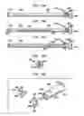 Fig. 72 - Instruments and methods for inserting artificial intervertebral implants
