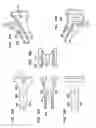 Fig. 85 - Instruments and methods for inserting artificial intervertebral implants