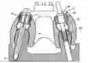 Fig. 01 - Method for producing a bone prosthesis or a pre-implant simulation, and equipment used
