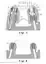 Fig. 03 - Method for producing a bone prosthesis or a pre-implant simulation, and equipment used