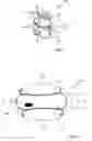 Fig. 02 - Fusing Bone