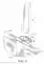 Fig. 04 - Universal sleeve for T-stakes in a flatbed trailer sidewall system