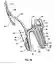 Fig. 16 - Chair back