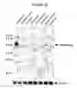 Fig. 13 - P450RAI-2 (P450 CYTOCHROME 26B), ENCODING NUCLEIC ACID MOLECULES AND METHODS AND USES THEREOF