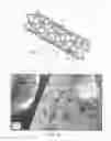 Fig. 02 - Drug-Eluting Endoprosthesis