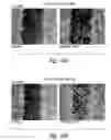 Fig. 25 - COMPOSITIONS AND METHODS FOR TREATING ASTHMA AND OTHER LUNG DISORDERS