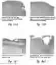 Fig. 26 - COMPOSITIONS AND METHODS FOR TREATING ASTHMA AND OTHER LUNG DISORDERS