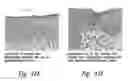 Fig. 27 - COMPOSITIONS AND METHODS FOR TREATING ASTHMA AND OTHER LUNG DISORDERS