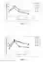 Fig. 03 - Modified exedins and uses thereof