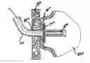 Fig. 01 - Anchor assembly