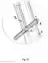 Fig. 05 - Anchor assembly