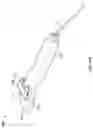 Fig. 23 - DEVICES AND METHODS FOR PERCUTANEOUS ENERGY DELIVERY