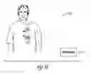 Fig. 09 - System and method for filtering neural stimulation