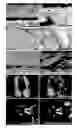 Fig. 01 - MODEL FOR MUSCULAR DYSTROPHY AND CARDIOMYOPATHY